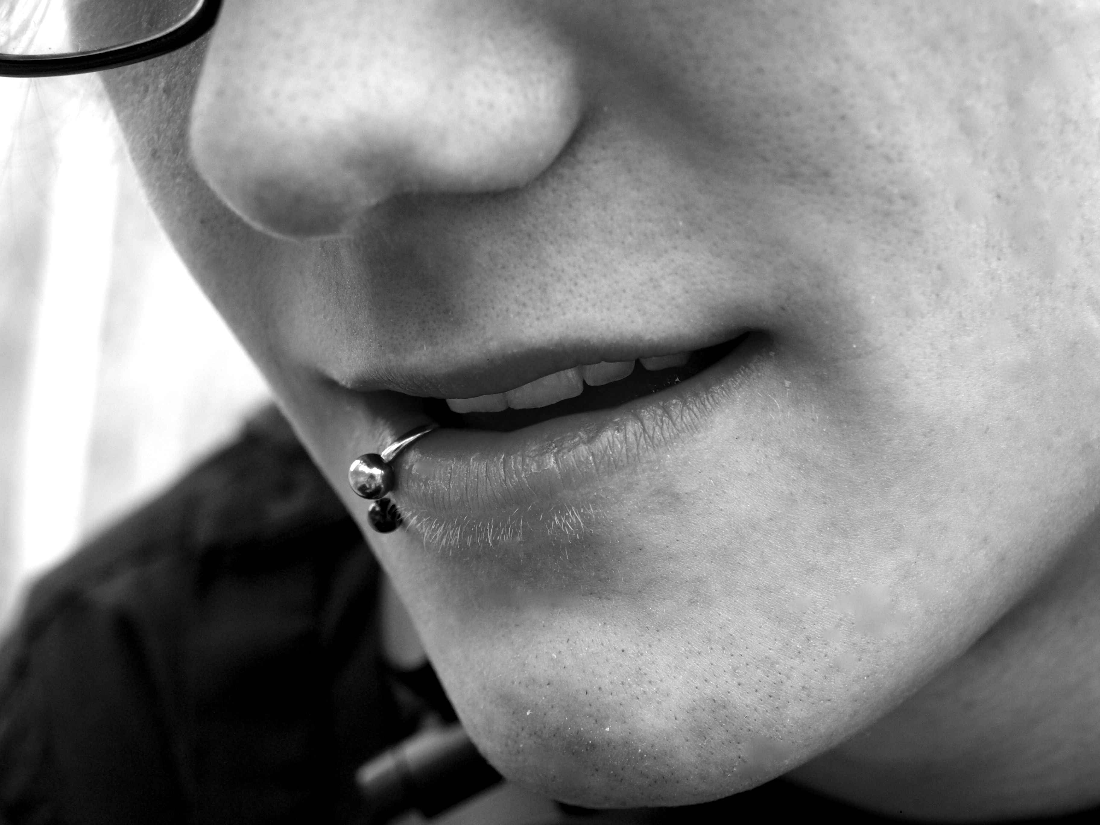 Fen's  Chin