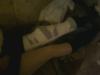 Leg post surgery